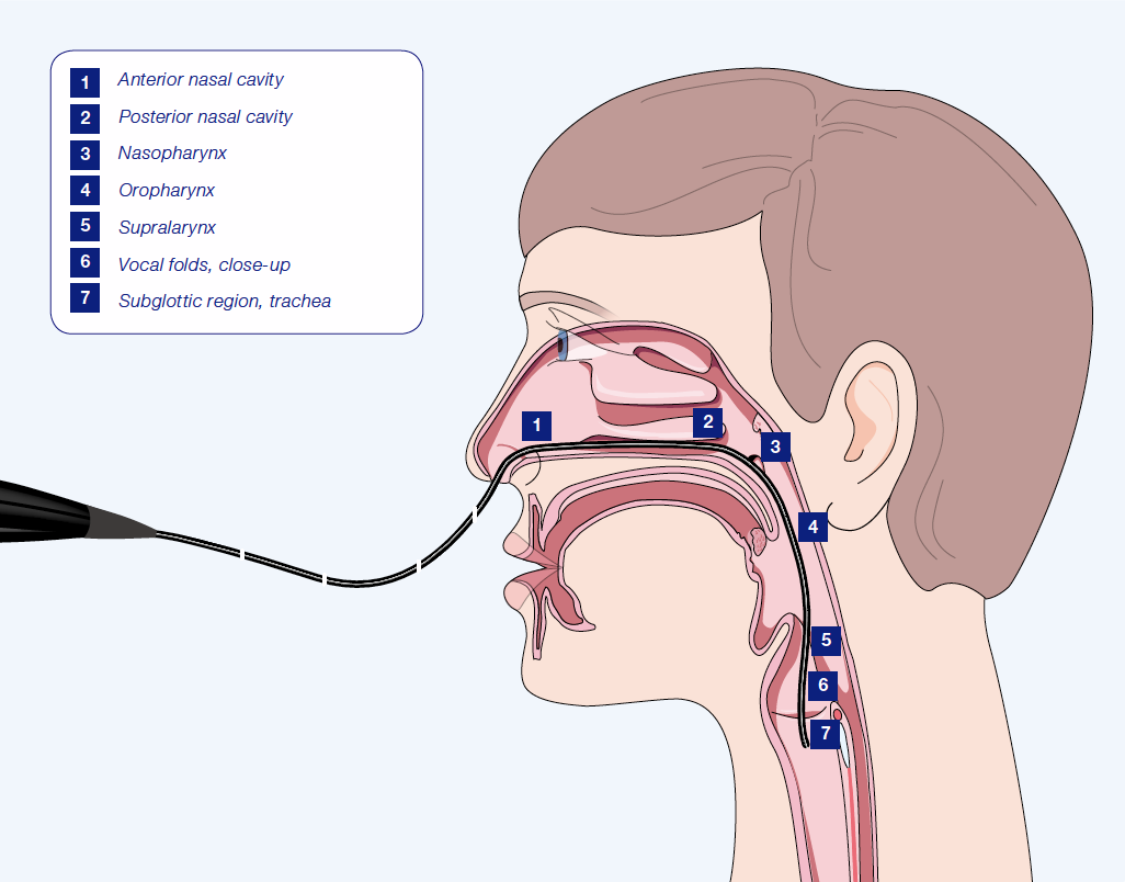 Endoscopy_Procedure